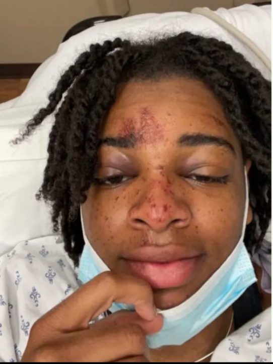 Bar Owner Charged in ‘Racially Fueled’ Attack on Black Student